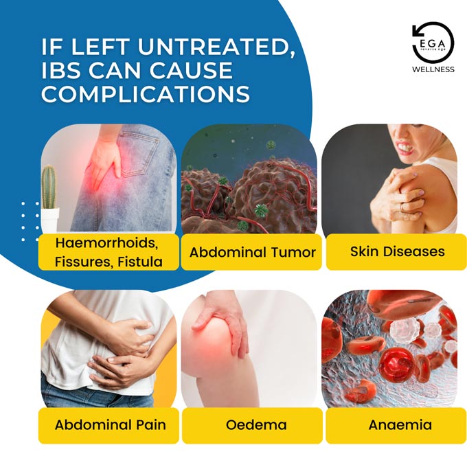 complications of untreated IBS include fissures, abdominal tumor, oedema, anaemia